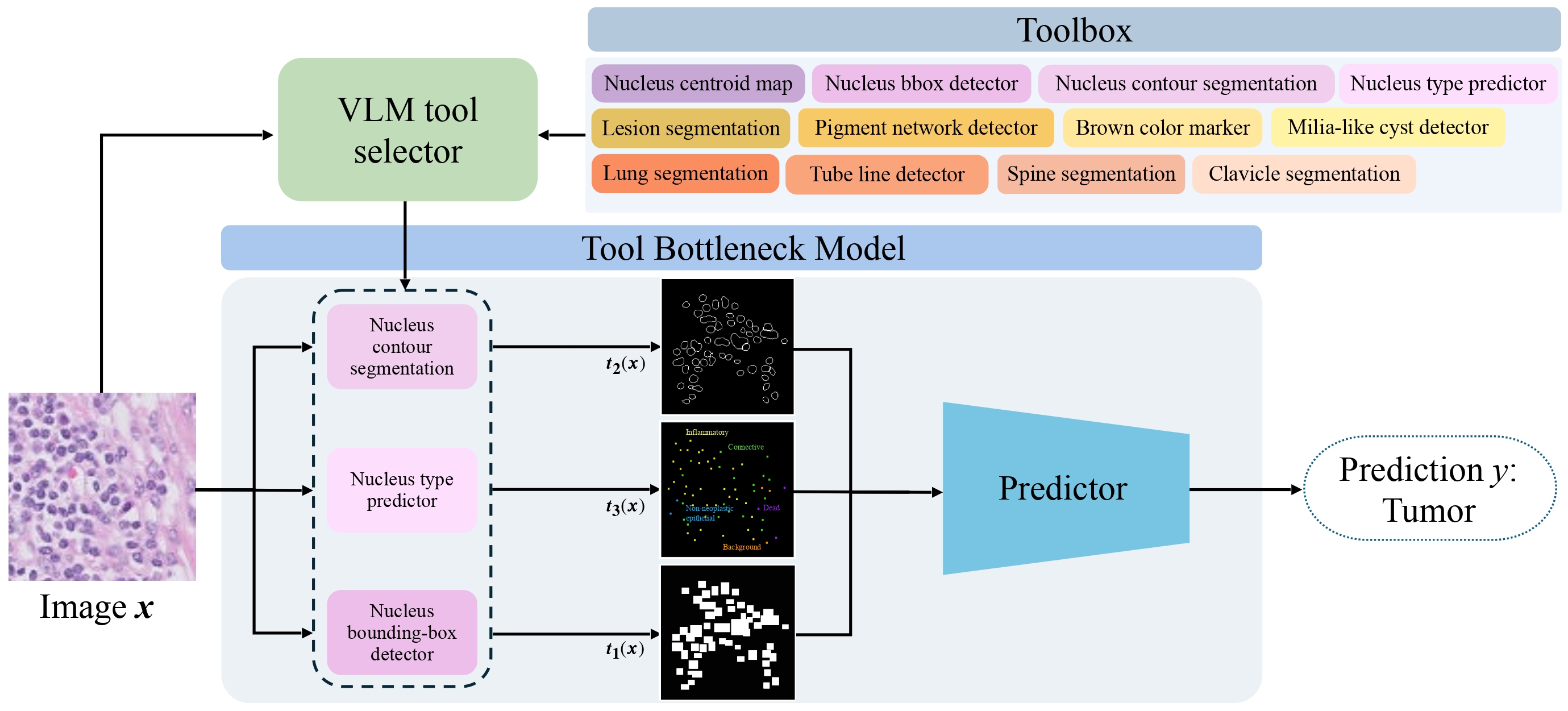 TBF Overview